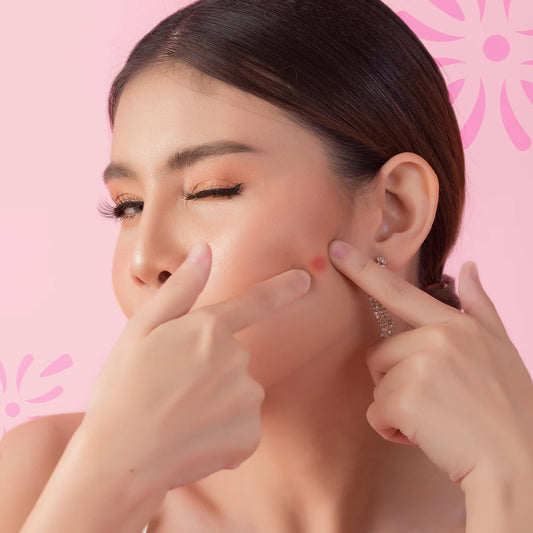 Acne Removal - How to Get Rid of Acne on Dry Skin