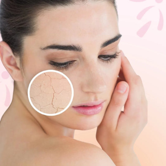 Let's debunk - 5 common Dry Skin Myths people still believe!