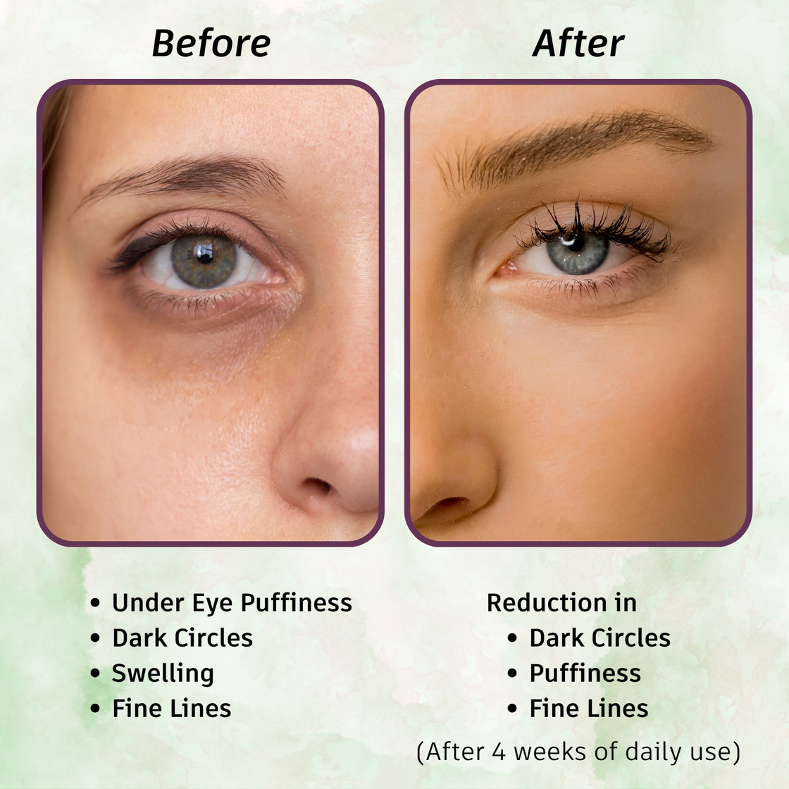 Oculyn Under Eye Gel
