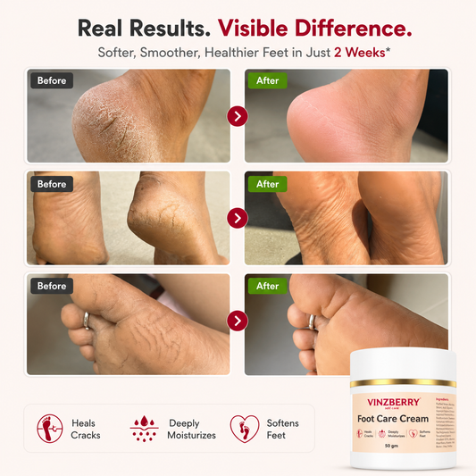 Foot Care Cream - 100gm